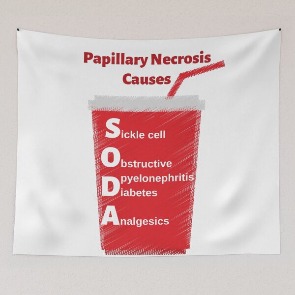 Item preview, Papillary Necrosis Causes: SODA Medical Mnemonic designed and sold by Caregiverology.