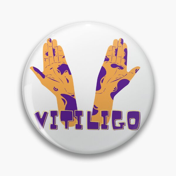 Item preview, vitiligo love sign  designed and sold by RAMS | رامس.