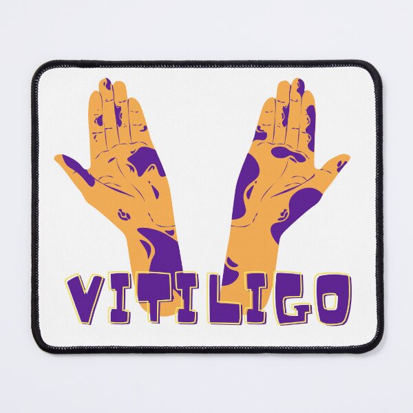 Item preview, vitiligo love sign designed and sold by RAMS | رامس.