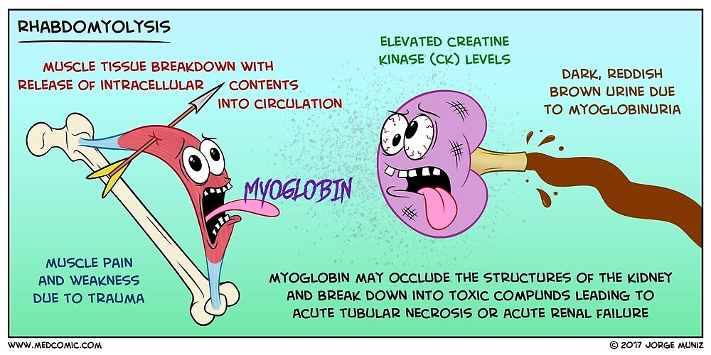 Rhabdomyolysis By Medcomic Redbubble   Flat,1000x1000,075,f.u5 