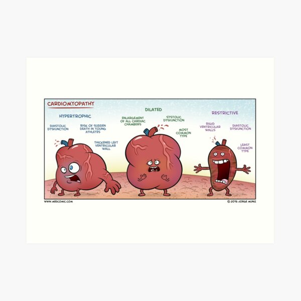 Cardiomyopathy Art Print