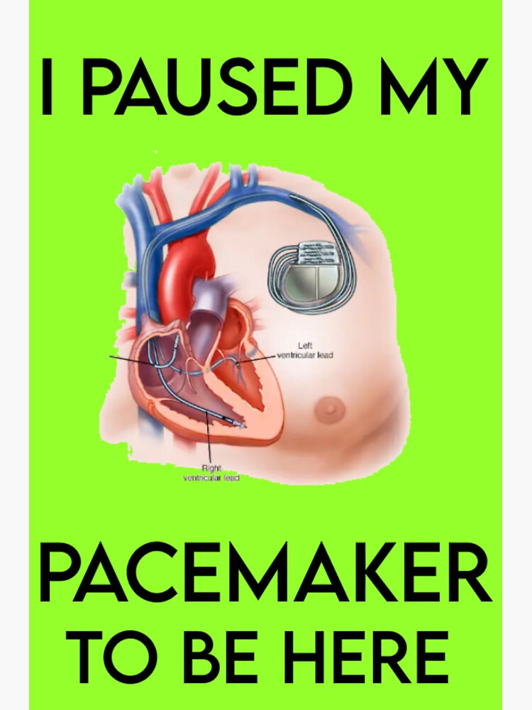 "Paused My Pacemaker to Be Here" Sticker for Sale by RNGEmporium