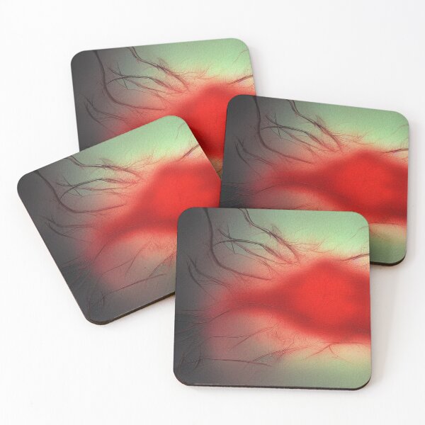 Item preview, cut disease designed and sold by MyOilArt4you.