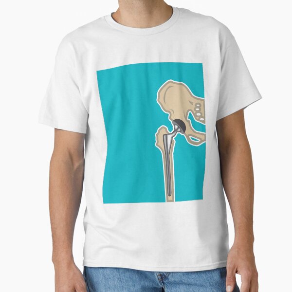 Item preview, Hip Joint replacement designed and sold by vectorworks51.