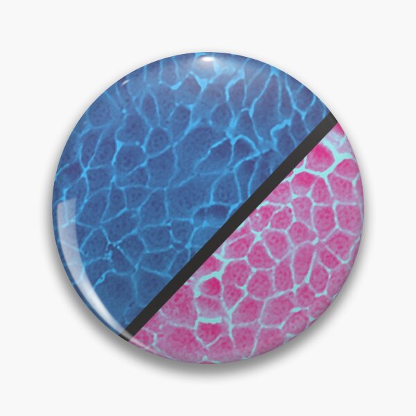 Item preview, Blue and pink epithelial cells under the microscope designed and sold by ArtByScience.