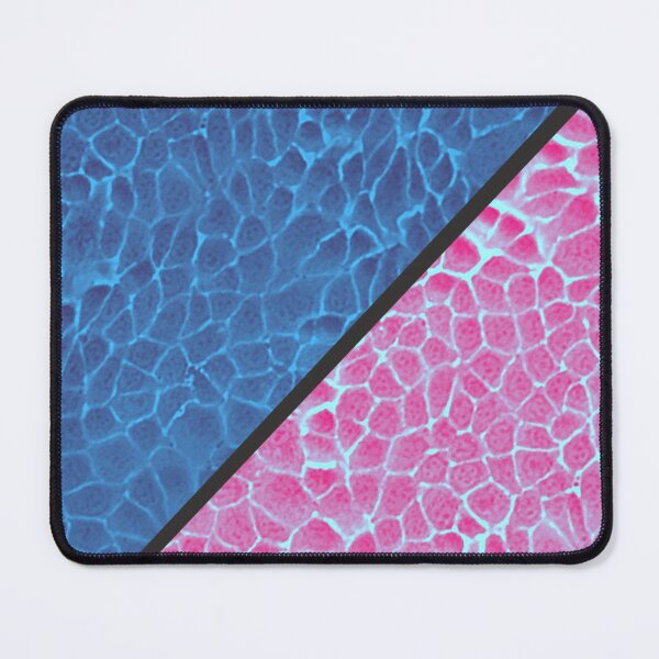 Item preview, Blue and pink epithelial cells under the microscope designed and sold by ArtByScience.