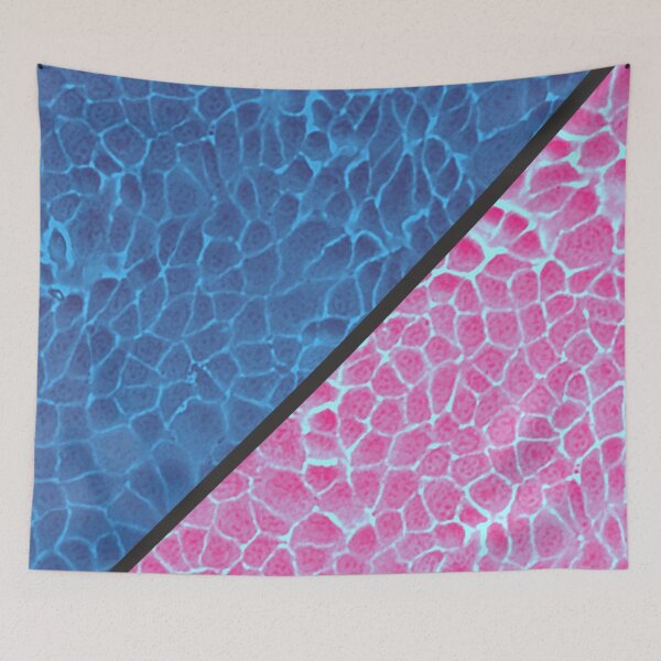 Item preview, Blue and pink epithelial cells under the microscope designed and sold by ArtByScience.