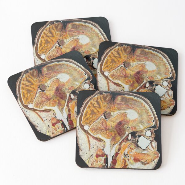 Item preview, Sagittal Thoughts designed and sold by eileenfaulk.