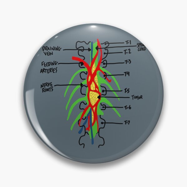 Item preview, greys anatomy tumor designed and sold by AleeneFord.