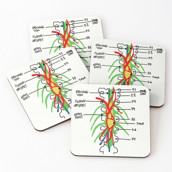 Item preview, greys anatomy tumor designed and sold by AleeneFord.