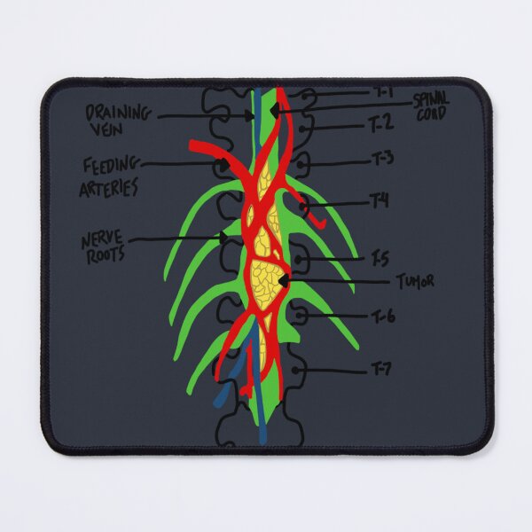 Item preview, greys anatomy tumor designed and sold by AleeneFord.