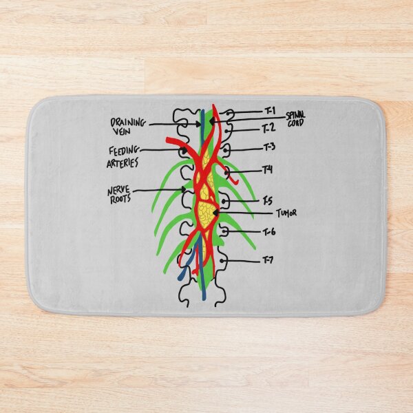 Item preview, greys anatomy tumor designed and sold by AleeneFord.