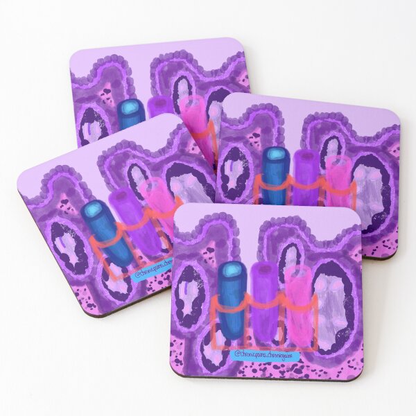 Item preview, Crohn's Histology Art designed and sold by clairelapat.