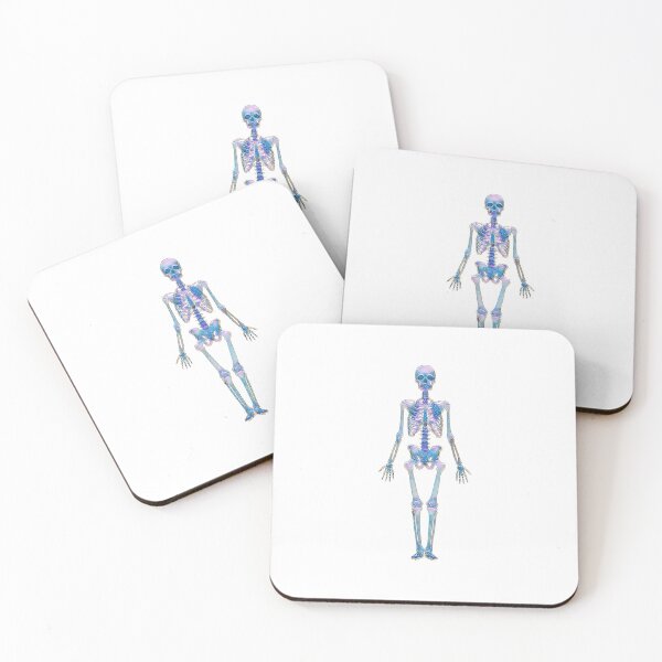 Item preview, Skeleton - phone cases and skins designed and sold by MOMO155.
