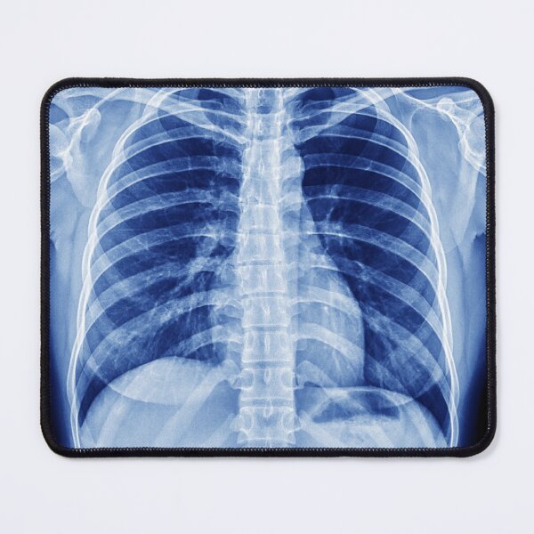 Item preview, Chest X-Ray designed and sold by rcmarble.