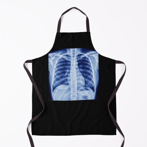 Item preview, Chest X-Ray designed and sold by rcmarble.