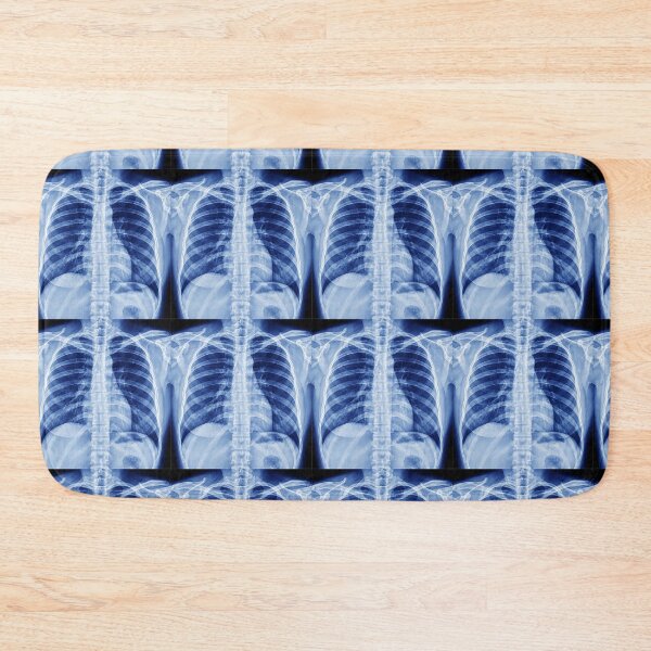 Item preview, Chest X-Ray designed and sold by rcmarble.