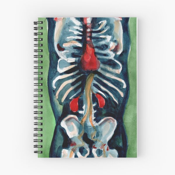 Item preview, Thoracoabdominal Angiograp designed and sold by Melss-jpg.