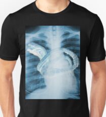 Chestburster X-Ray Unisex T-Shirt