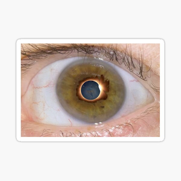 Item preview, Eclipse, my eye burns. designed and sold by E-W-D.
