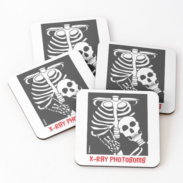 Item preview, X-Ray Photobomb designed and sold by Dave Hussell.