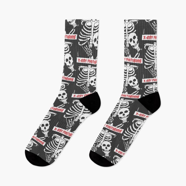 Item preview, X-Ray Photobomb designed and sold by Dave Hussell.