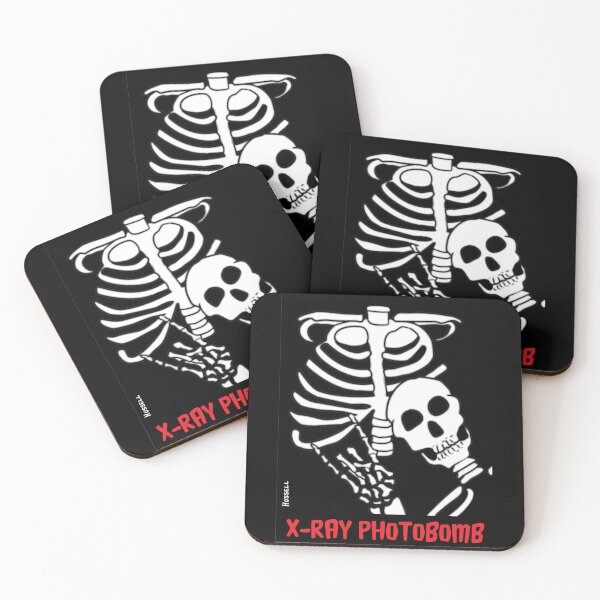 Item preview, X-Ray Photobomb designed and sold by Dave Hussell.