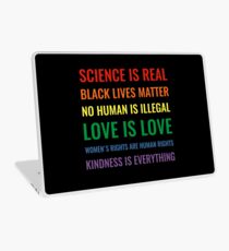 Science is real! Black lives matter! No human is illegal! Love is love! Women's rights are human rights! Kindness is everything! Shirt Laptop Skin
