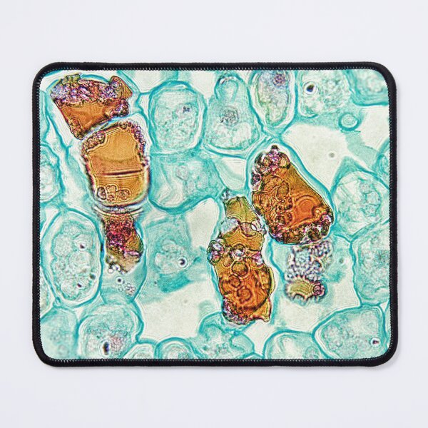 Item preview, cycad tree, fat cells; plant anatomy, microscopy designed and sold by everydaybotany.