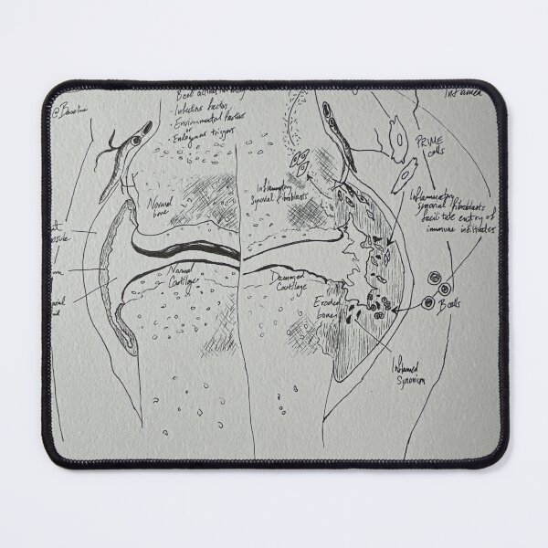 Item preview, Inflamed joint designed and sold by neuraloot.