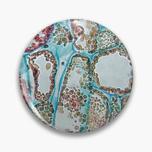 Item preview, pine cone, fat cells; plant anatomy, microscopy designed and sold by everydaybotany.