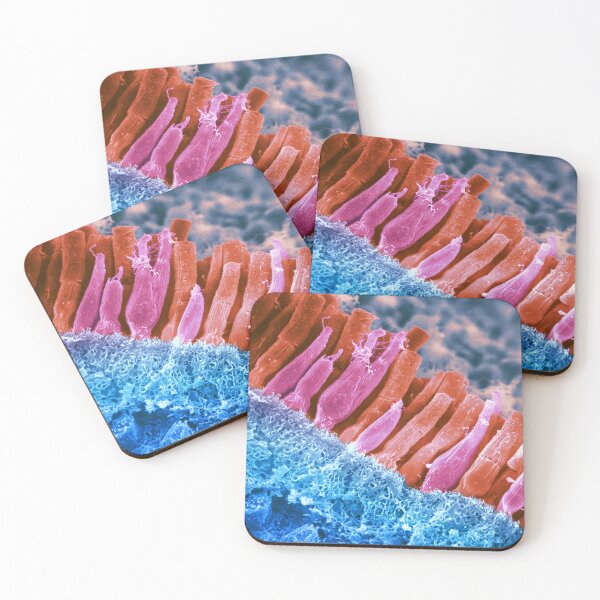 Item preview, Microscope Photo of the Rods and Cones of the Human Eye, SEM designed and sold by ScienceSource.