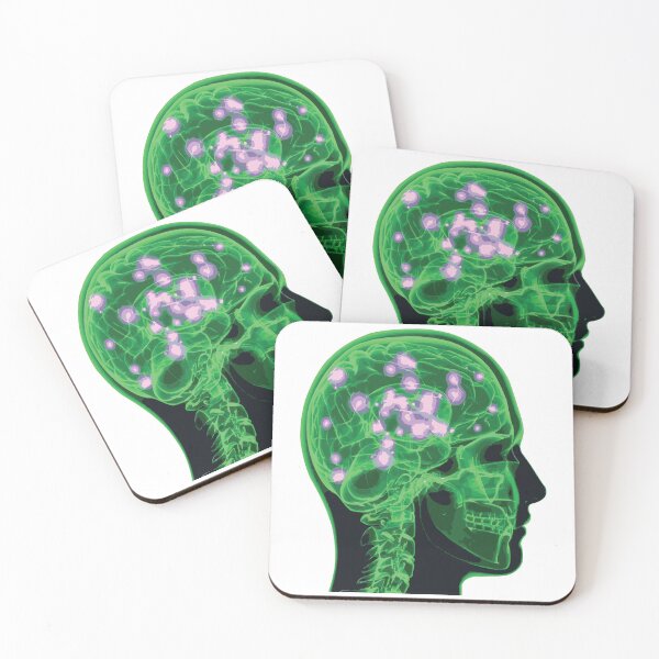 Item preview, Electrical Brain Activity (Green) designed and sold by Synteny.