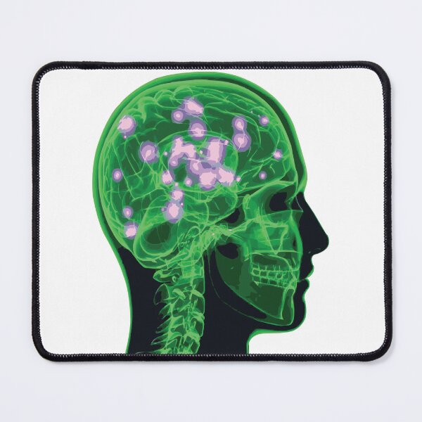 Item preview, Electrical Brain Activity (Green) designed and sold by Synteny.