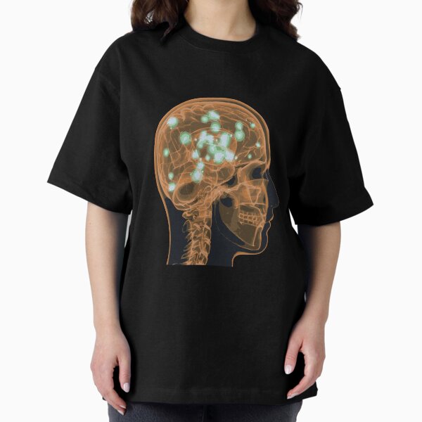 Item preview, Electrical Brain Activity (Orange) designed and sold by Synteny.