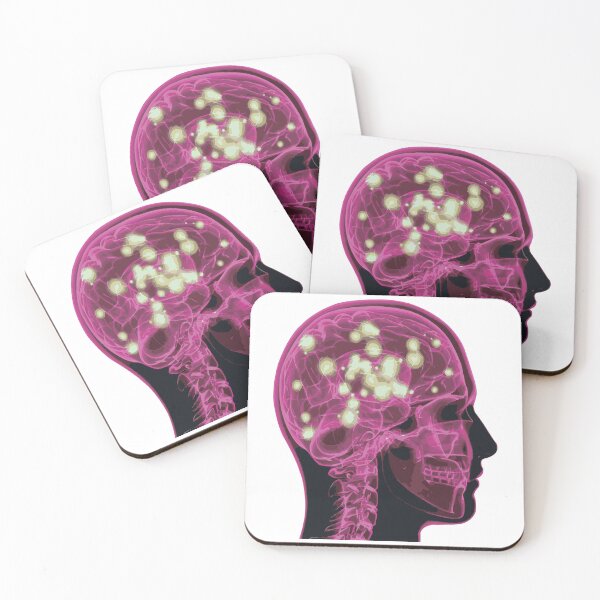 Item preview, Electrical Brain Activity (Pink) designed and sold by Synteny.