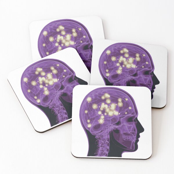 Item preview, Electrical Brain Activity (Purple) designed and sold by Synteny.