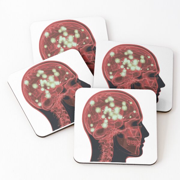 Item preview, Electrical Brain Activity (Red) designed and sold by Synteny.