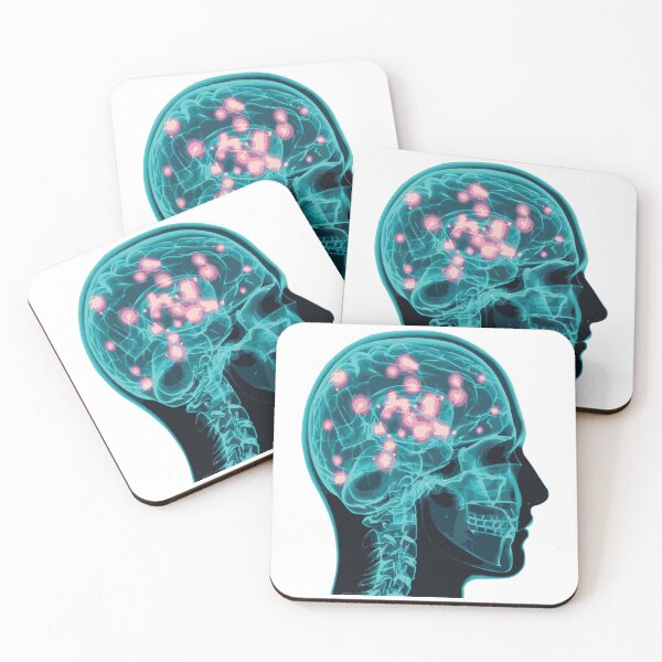 Item preview, Electrical Brain Activity (Teal) designed and sold by Synteny.