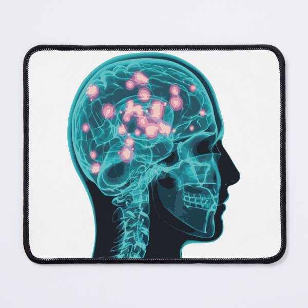 Item preview, Electrical Brain Activity (Teal) designed and sold by Synteny.