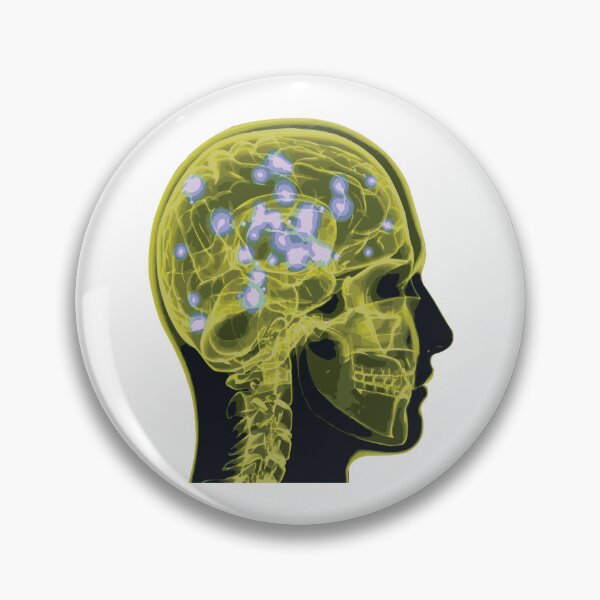 Item preview, Electrical Brain Activity (Yellow) designed and sold by Synteny.
