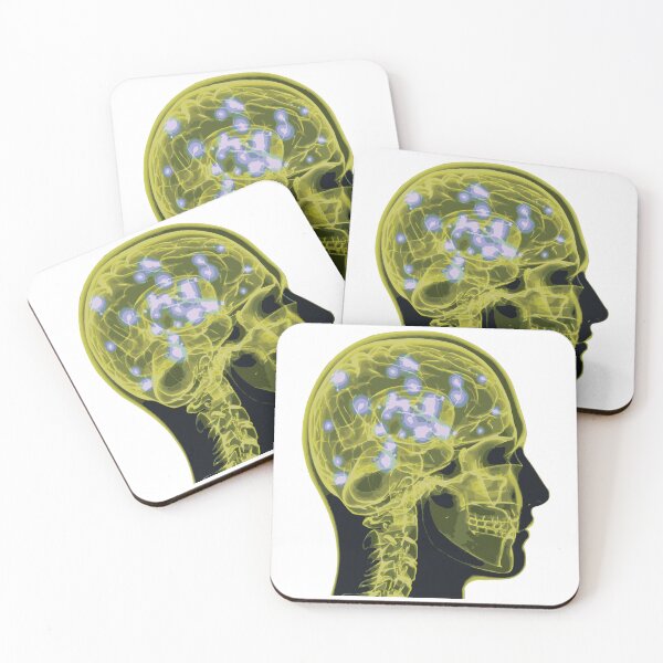 Item preview, Electrical Brain Activity (Yellow) designed and sold by Synteny.