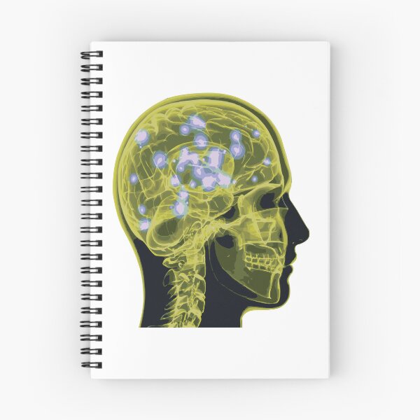 Item preview, Electrical Brain Activity (Yellow) designed and sold by Synteny.