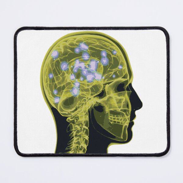 Item preview, Electrical Brain Activity (Yellow) designed and sold by Synteny.
