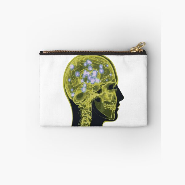 Item preview, Electrical Brain Activity (Yellow) designed and sold by Synteny.