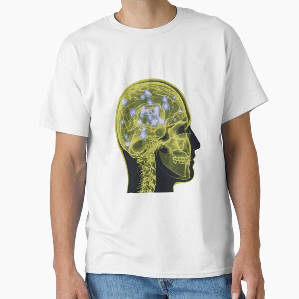 Item preview, Electrical Brain Activity (Yellow) designed and sold by Synteny.