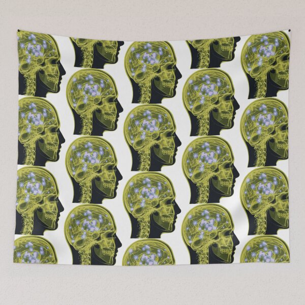 Item preview, Electrical Brain Activity (Yellow) designed and sold by Synteny.
