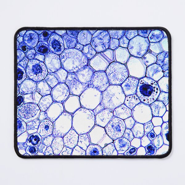 Item preview, Neottia orchid, root fat cells; plant anatomy, microscopy designed and sold by everydaybotany.