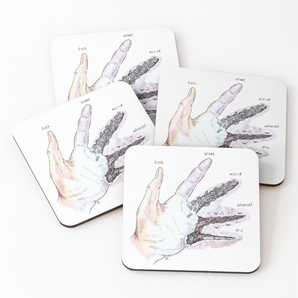 Item preview, Stages of Decay Hand by Skye Rain Art designed and sold by Skye Rain.