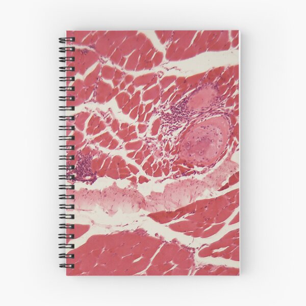 Item preview, Trichinella spiralis larvae in muscle tissue under the microscope. designed and sold by Zosimus.